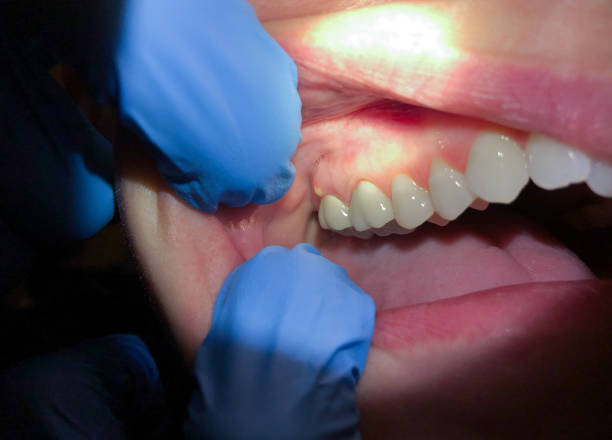 Best Emergency Orthodontic Repairs in Lindsborg, KS