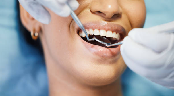 Best Emergency Tooth Extraction in Lindsborg, KS