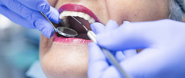 Best Emergency Tooth Extraction in Lindsborg, KS